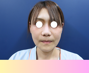 顔 before