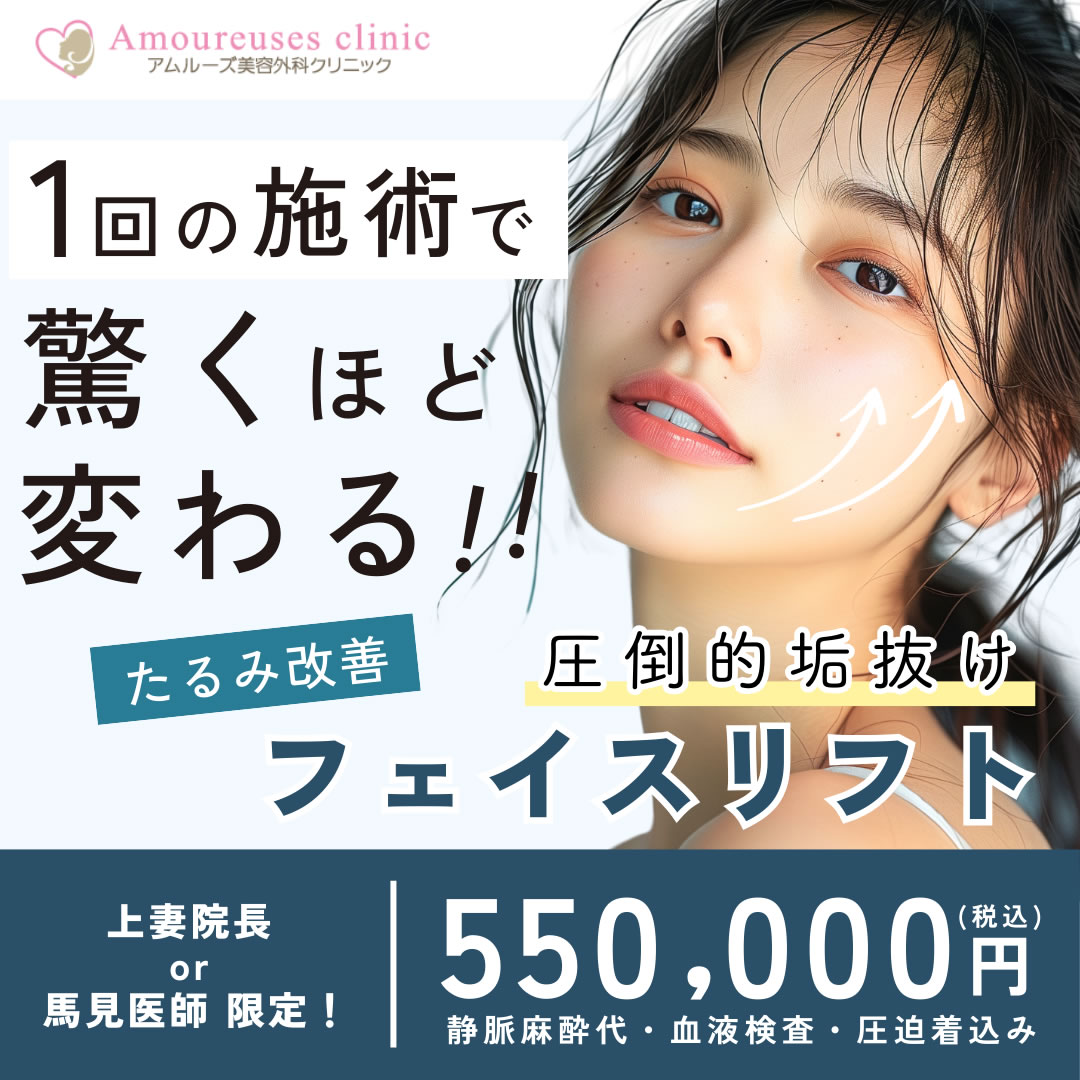 たるみ改善フェイスリフト