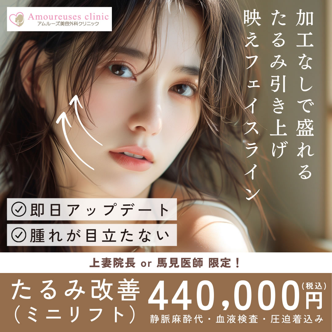 たるみ改善 ミニリフト