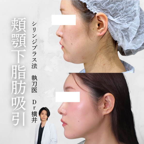 顔