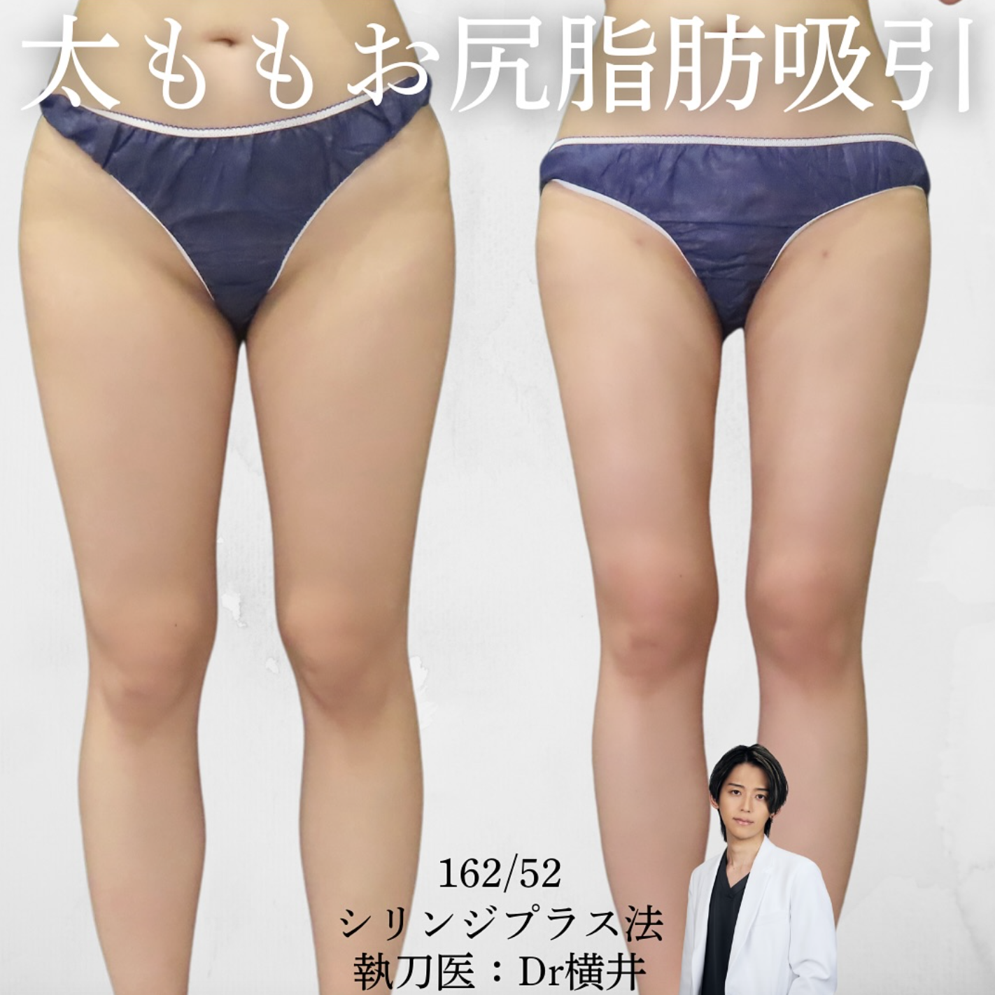 脚