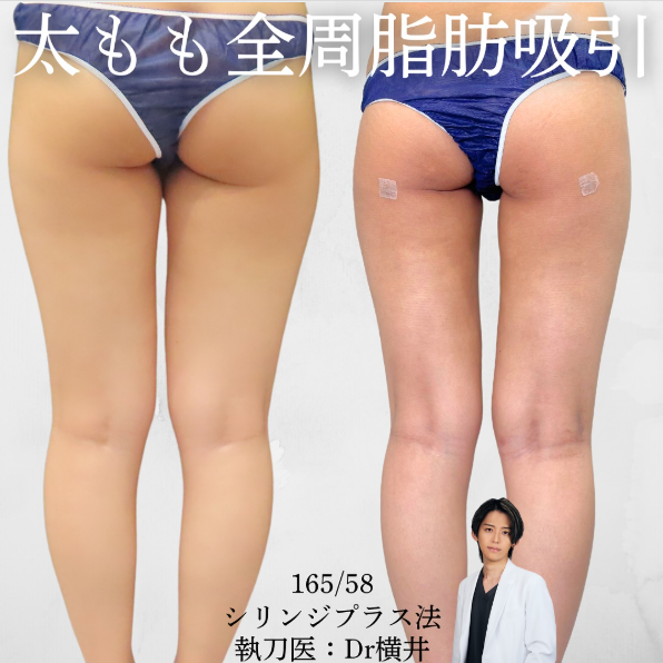 脚
