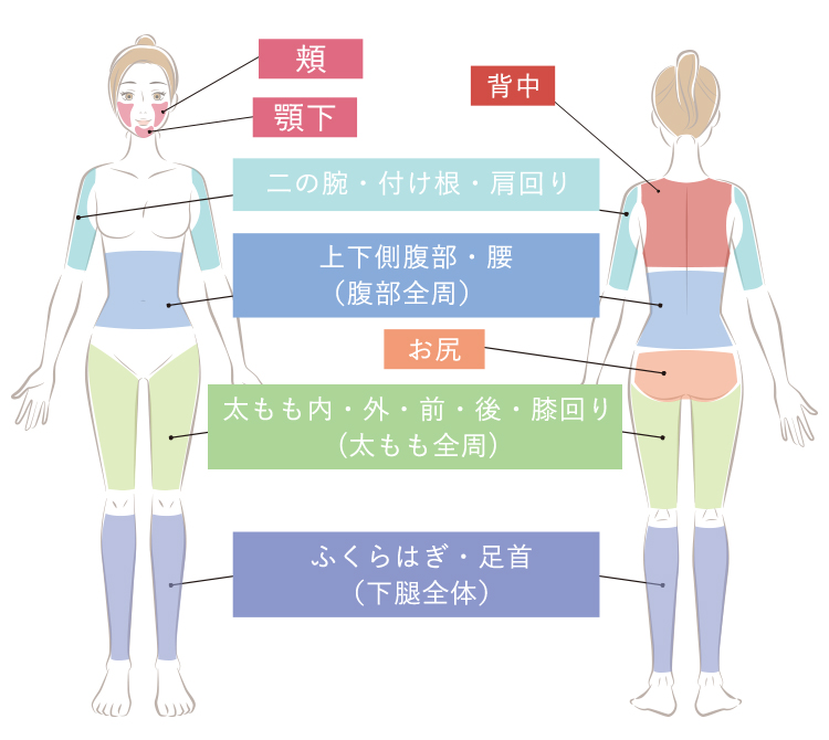 脂肪吸引可能部位
